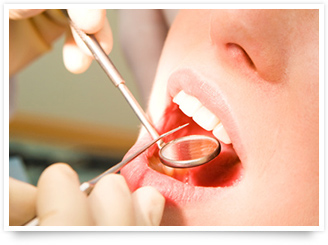 歯周の基本検査（Ｐ検査）