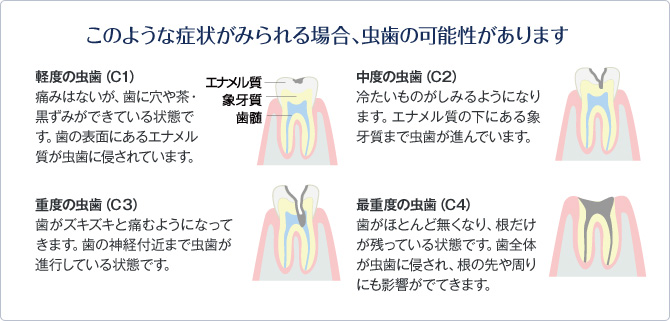 このような症状がみられる場合、虫歯の可能性があります