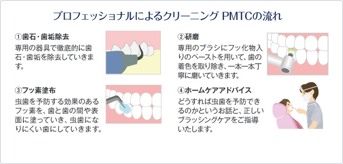 プロフェッショナルによるクリーニング PMTCの流れ