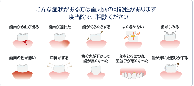 以下のような症状がある方は歯周病の可能性があります