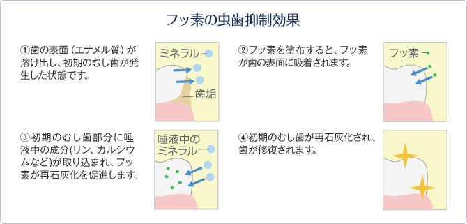 フッ素の虫歯抑制効果